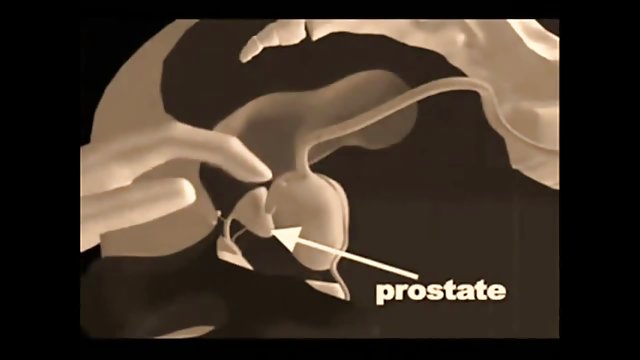یک دانش آموز اینستاگرام سکس دکتر به یک معلم فیزیک تجاوز کرد.